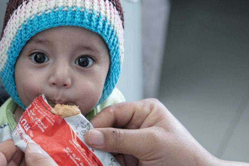 112 þúsund börn undir fimm ára hafa fengið lífsnauðsynlega meðhöndlun við vannæringu í Jemen á þessu ári. Ljósmynd: UNICEF - mynd