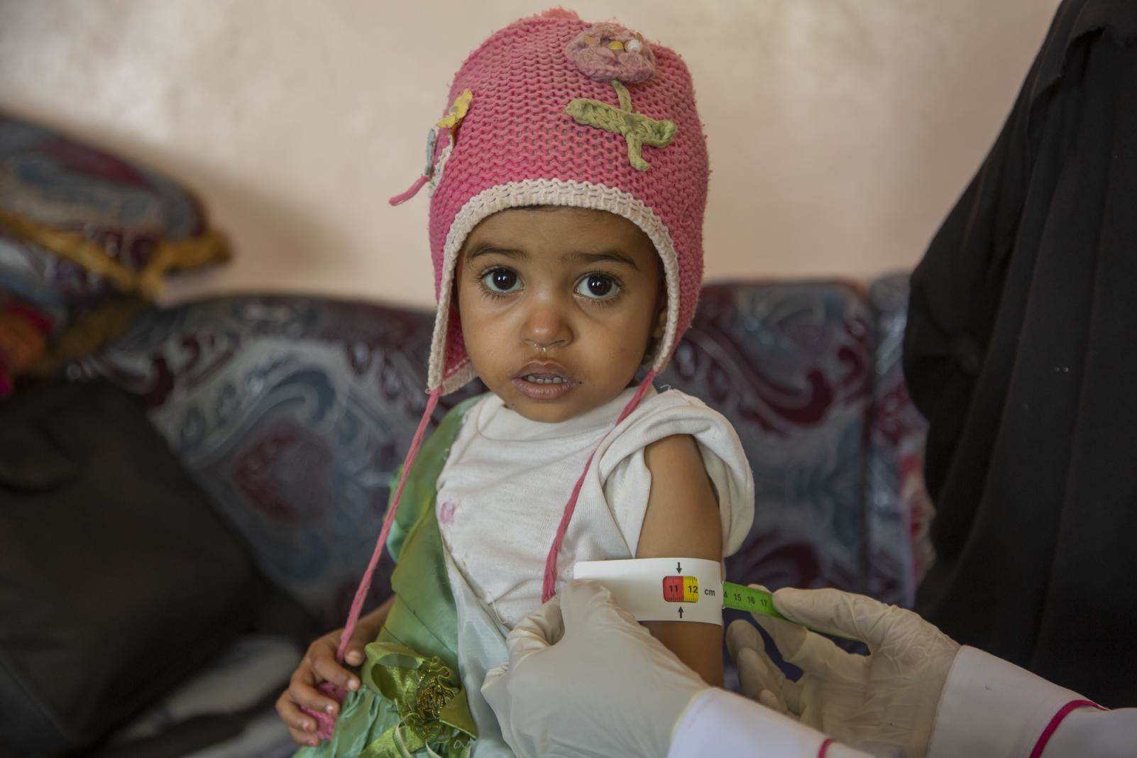 Ljósmynd: UNICEF/Almahbashi - mynd